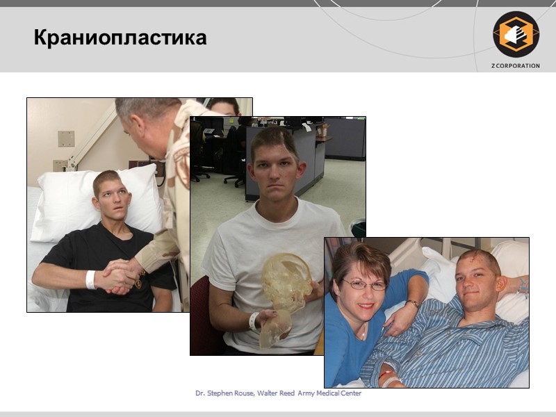 Краниопластика Dr. Stephen Rouse, Walter Reed Army Medical Center